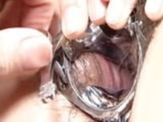 japanese URETHRA ILLUSTRATIONS2.mp4