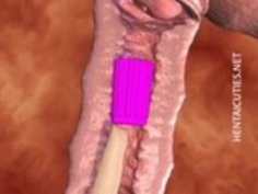 アニメ天使の寝室で女陰をいじります