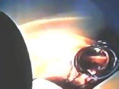 （035）Zhangjiajing看護師（台湾）